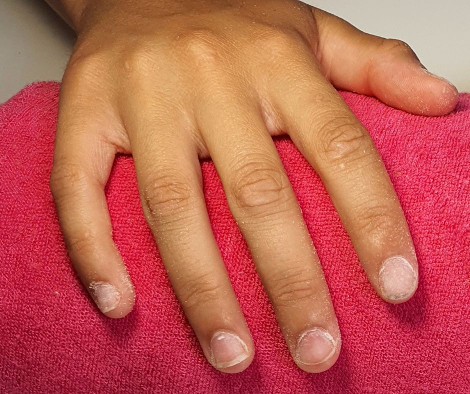 Ongles - capsule américaine - avant